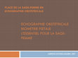 Research paper thumbnail of ECHOGRAPHIE OBSTETRICALE BIOMETRIE FOETALE L'ESSENTIEL POUR LA SAGE- FEMME