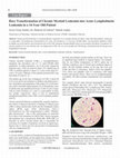 Research paper thumbnail of Rare Transformation of Chronic Myeloid Leukemia into Acute Lymphoblastic Leukemia in a 14-Year Old Patient