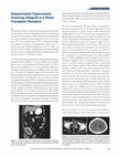 Research paper thumbnail of Disseminated Tuberculosis Involving Allograft in a Renal Transplant Recipient