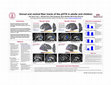 Research paper thumbnail of Dorsal and ventral fiber tracts of the pOTS in adults and children