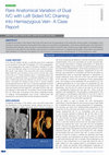 Research paper thumbnail of Rare Anatomical Variation of Dual IVC with Left Sided IVC Draining into Hemiazygous Vein- A Case Report