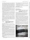 Research paper thumbnail of FRI0473 ASSESSMENT of Femoral Vein Wall Thickness with Doppler Us as a Diagnostic Tool for Behcet’s Disease