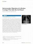 Research paper thumbnail of Intravascular migration of a broken cerclage wire into the left heart