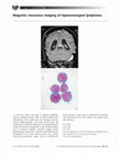 Research paper thumbnail of Magnetic resonance imaging of leptomeningeal lymphoma