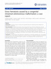 Research paper thumbnail of Gross hematuria caused by a congenital intrarenal arteriovenous malformation: a case report