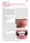 Research paper thumbnail of Cutaneous sinus tract in association with traumatic injury to the teeth