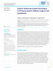 Research paper thumbnail of Gastric Adenocarcinoma Secondary to Primary Gastric Diffuse Large B-cell Lymphoma