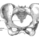 Anatomical drawing of pelvis depicting sexual dysfunction after pelvic fracture