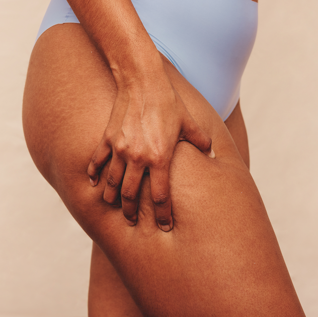 how to get rid of cellulite