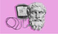 composite image of a greek statue's head hooked up to a bag of blood on a pink background