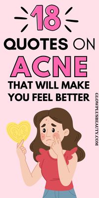 Click to read the article. Acne quotes motivation, skin quotes, skin care quotes, skin advice, acne positivity, skin aesthetics, skin facts, body positivity, normal quotes, self compassion quotes, love your skin