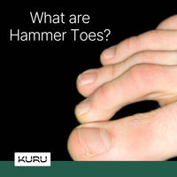 Fabricated with extra depth and a larger toe box. Redness, inflammation, or a burning sensation around the toes, are common problems for people with hammer toes. Don’t worry, KURU shoes are also designed to help with these issues.