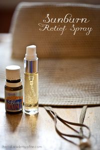 3 Ways To Prevent Sunburn + A DIY Sunburn Relief Spray