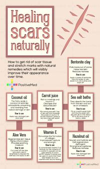 Healing Scars Naturally, good info! I've tried the Vitamin E Oil and it does help. (though it takes patience)