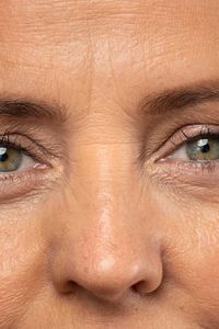 Do you want to know how to get rid of glabellar lines without Botox? Here are the top 6 natural ways to get rid of frown lines.