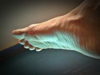 10 Ways to Fix Your Plantar Fasciitis--for Good!