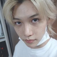 Felix and his freckles