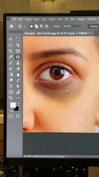 How to remove an extreme dark circle in adobe photoshop tutorial @sabinashimaa Follow me for more adobe photoshop and adobe illustrator interesting tutorials ✌🏻🥰