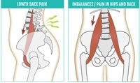 There are countless suggestions out there on how to access and stretch the psoas. The question is – is it always appropriate to stretch a tight psoas?