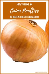 How to Make an Onion Poultice to Relieve Chest & Cough Congestion - Real Food RN | Natural Remedies Cold & Cough