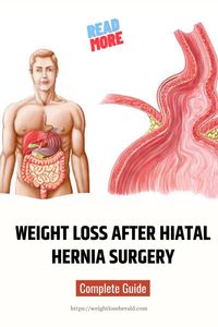 Weight loss after hiatal hernia surgery is important for managing symptoms and improving long-term outcomes. A healthy diet and gradual lifestyle changes can support healing and prevent complications. Consult with a healthcare provider for personalized recommendations, hernias in women, survival guide #herniasinwomen