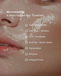 Microneedling is one of our top-selling facial treatments that uses tiny needles to create micro-channels in the skin, stimulating collagen production and improving the texture, tone, and overall appearance of your skin.   Ready to try microneedling? For a limited time we're offering the Repair and Rejuvenate Trio, the ultimate solution for a healthy, smooth complexion!  Available now for the amazing price of only $699 (Value of $853)!   ➡️ Use Code: REPAIR to purchase online