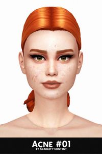 # 3 in our list of custom acne skin details for The Sims 4. Peep the full list for even more realistic acne mods!