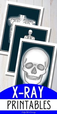 Turn an afternoon of science learning into a fun opportunity to learn about the human anatomy and biology with my special X-ray printables for kids. Get easy to print images of the skull, our entire body, hands, foot and more!