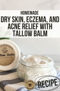 What’s my secret weapon for all things skin-related? Tallow, of course! Because it is so similar to our own skin cells, tallow is the perfect moisturizer and healer for skin. It sounds crazy. Rub beef fat into your skin? But once you try tallow balm, there’s no going back! As soon as you take a little bit and start to rub it into your skin, you’ll experience it: deep, soothing moisture. This is an updated tutorial of my favorite tallow balm recipe for dry skin, eczema, acne, anti-aging & more!