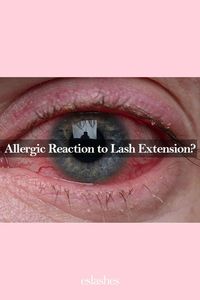 Allergic Reaction to Lash Extensions? Lash extensions enhance appearance and provide longer, fuller, and more dramatic eyelashes. Be aware of potential risks and allergic reactions. Explore causes, symptoms, prevention, and treatment in this article. #lashextensions #lashcare #lashaftercare #eyelashextensions #eslashes #lashes