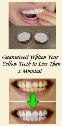 Guaranteed! Whiten Your Yellow Teeth In Less Than 2 Minutes!