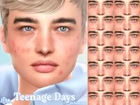 The Sims Resource - Teenage Days - Acne