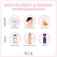 WHAT IS HYPERPIGMENTATION? Hyperpigmentation is caused by an increase in melanin. Melanin is the natural pigment that gives our skin, hair and eyes their color. A number of factors can trigger an increase in melanin production, but the main ones are sun exposure, hormonal influences, age and skin injuries or inflammation.  HOW TO PREVENT HYPERPIGMENTATION? Although not all causes of hyperpigmentation can be prevented, there are some steps you can take to prevent certain instances of hyperpigmentation:  - Avoid direct sunlight - Incorporate Vitamin C into your routine - Apply SPF daily - Avoid picking your spots  HOW TO TREAT HYPERPIGMENTATION? If you already have some form of hyperpigmentation, then I recommend the following to help tackle it:  - Chemical peels - Chemical exfoliation - Ret