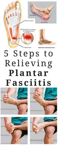 5 Steps To Relieving Plantar Fasciitis Pain