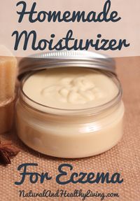 This is a homemade eczema cream recipe. It's all natural lotion! Natural remedies for eczema are hard to come by and this cream is safe for children too!