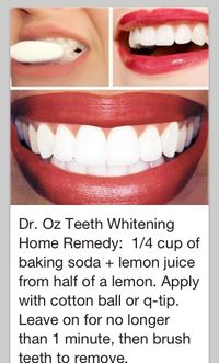 Teeth whitening