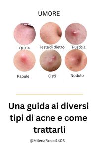 #acne #acne #acnetreatment #trattamentoperl'acne #acnefacemask #mascheraperilvisocontrol'acne #acneroutineskincare #curadellapellediroutineperl'acne #acneskincareroutinenight #Routinenotturnaperl"acuradellapelle #control'acne #acnereams #cremeperl'acne