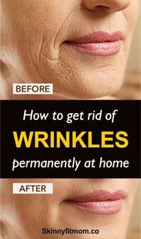 How To Get Rid Of Wrinkles and Spots By Just Using This At Home >>CHECK THIS OUT<<