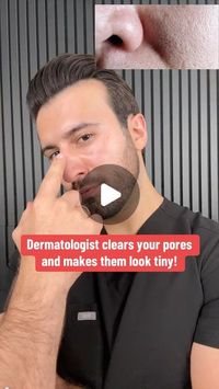 Dr. Chris Tomassian on Instagram: "Pore rescue from your dermatologist!   Use this routine and keep me posted 🙏 . . . . . . #skincare #skincaretips #skincareroutine #dermatologist #pores #bigpores #doctor"