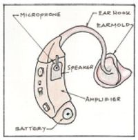 This source gives a great insight to the differences of how a hearing impairment could affect a child and the things people need to be aware of when communicating with a child with an hearing impairment.