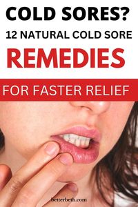 How to Get Rid of Cold Sore: 12 Natural Cold Sore Remedies for Fast Relief | Natural Cold Remedies