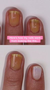 If you have yellow or discolored nails, you've got to try this! In less than 5 minutes, bright perfect-looking nails.