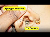 Earwax buildup can be embarrassing. Hydrogen peroxide for earwax removal is a safe, affordable, and effective way to dissolve excess earwax from the ear canal.