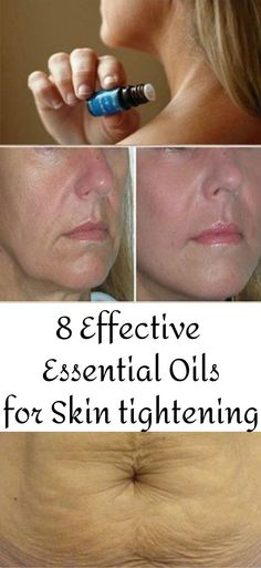 Skin Tightening Essential Oil, For Skin Tightening, Essential Oils Health, Essential Oils For Skin, Skin Care Wrinkles, Saggy Skin, Skin Aging, Skin Remedies, Skin Care Remedies