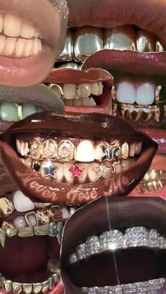 Grillz Aesthetic Wallpaper, Grillz For Females Aesthetic, Black Art Grillz, Women With Grillz Gold Teeth, Christmas Outfits Teens, 2 Piece Grillz, Xoxo Jewelry