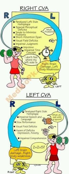 two cartoon images showing the differences between left and right caa