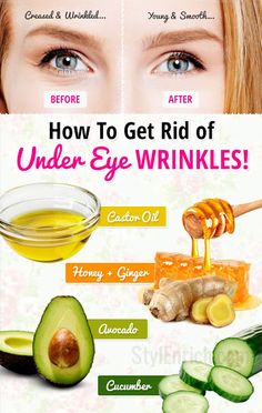 Under eye wrinkles Under Eye Creases, Homemade Face Mask, Skin Care Routine For 20s, Brown Spots On Face, Remove Dark Circles, Healthy Advice