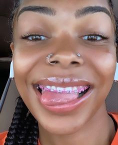 Pink Braces Power Chain, Hot Pink Braces Teeth, Rose Pink Braces, Braces With Power Chains, Braces Pink Bands, Braces Colors On Dark Skin, Power Chain Braces Colors, Powerchain Braces Aesthetic, Pink Power Chain Braces