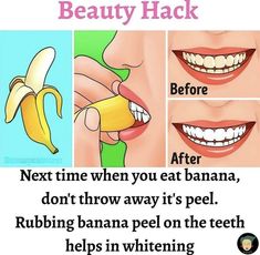 Remedies For Skin, Teeth Whitening Diy, Healthy Facts, Clear Healthy Skin, Natural Skin Care Remedies, Diy Skin Care Routine, Body Features