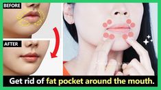 Bigger Lips Naturally, Facial Exercise, Dip Workout, Tooth Repair, Korean Lips, Dental Cavities, Tooth Sensitivity, Lip Beauty